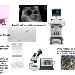 Fertilidad Clarísima | Foto:CEDOC