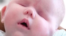 Bebé de Poplar Bluff nace con un raro trastorno genético 20240207
