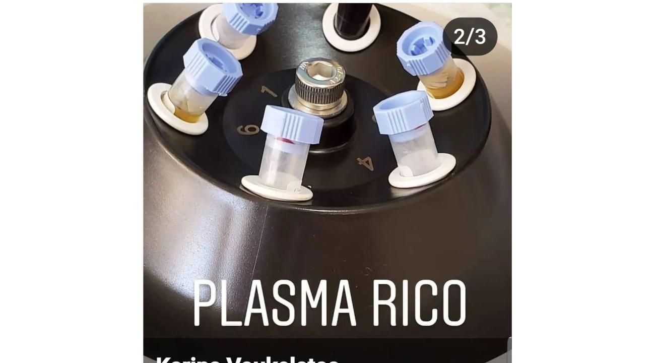 BENEFICIOS DEL PLASMA RICO EN PLAQUETAS 