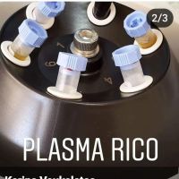 BENEFICIOS DEL PLASMA RICO EN PLAQUETAS 