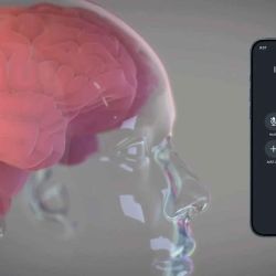 El chip cerebral permitiría comunicarse con dispositivos varios. | Foto:Gentileza Neuralink.
