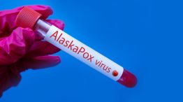 El Alaskapox provoca su primera muerte conocida en un residente de Alaska