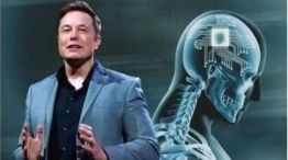 Neuralink, el primer implantado con el chip cerebral de Elon Musk ya controla un mouse con el pensamiento