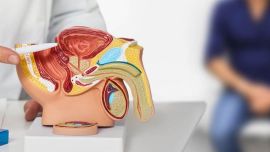 Estudios contra el cáncer de prostata