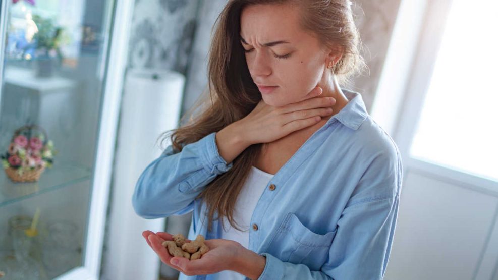 Alergias alimentarias 20240227