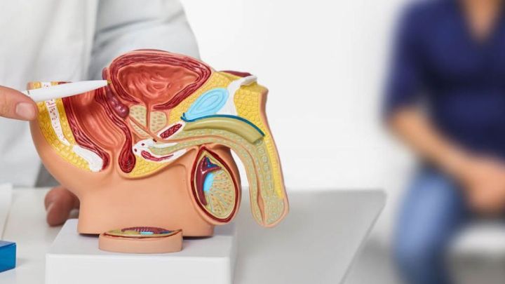 Qué opinan los especialistas sobre el cáncer de próstata con metástasis ósea que le detectaron a Joe Biden | Perfil