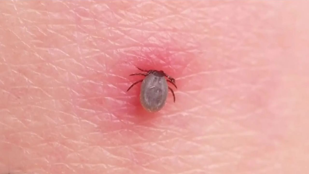 Qué es el virus Powassan, descubierto en un ciudadano de Rhode Island, Estados Unidos | Perfil