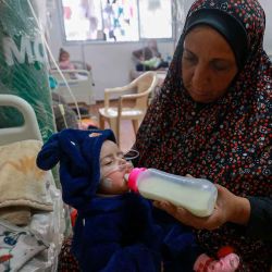 Los niños palestinos que sufren desnutrición reciben tratamiento en un centro de salud en Rafah, en el sur de la Franja de Gaza. Foto de MOHAMMED ABED / AFP | Foto:AFP