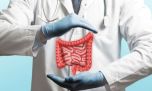 Cáncer de colon: el 90% de los casos se puede prevenir y curar