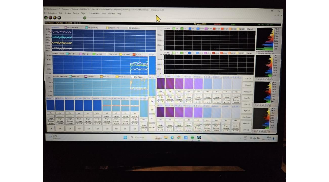 Autismo y un nuevo tratamiento en Argentina