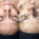 Limpieza Facial Profunda: Descubre el Secreto para una Piel Radiante
