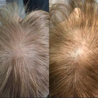 Limpieza Facial Profunda: Descubre el Secreto para una Piel Radiante
