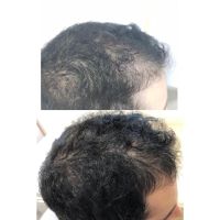 Limpieza Facial Profunda: Descubre el Secreto para una Piel Radiante