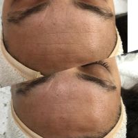 Limpieza Facial Profunda: Descubre el Secreto para una Piel Radiante