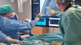 Cardiólogos advirtieron que la colocación de stents y la realización de angioplastías 20240513