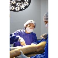 Varices: Más que un Problema Estético