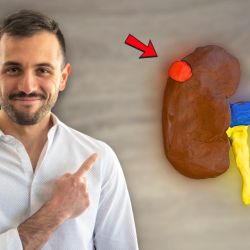 Diagnóstico, Importancia y Tratamiento Mínimamente Invasivo de los Quistes y Tumores Renales,  por el Urólogo Mauro Carrillo | Foto:CEDOC