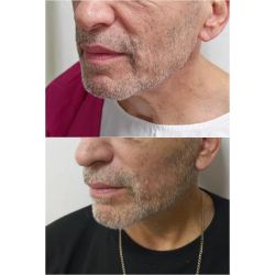 Rejuvenecé tu rostro: La solución del lifting para una apariencia fresca y natural | Foto:CEDOC