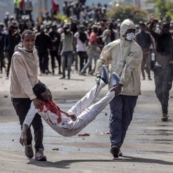 Los manifestantes llevan a un hombre herido frente al Parlamento de Kenia durante una huelga nacional para protestar contra los aumentos de impuestos y el Proyecto de Ley de Finanzas 2024 en el centro de Nairobi. | Foto:LUIS TATO/AFP