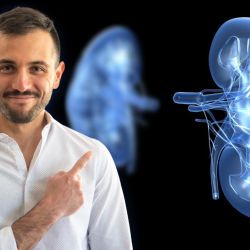 Tratamiento Quirúrgico del Cáncer Renal localizado: En qué consiste una Cirugía laparoscópica de Riñón por el Urólogo Mauro Carrillo | Foto:CEDOC