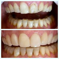 “La sonrisa también envejece: Cómo revertir el paso del tiempo por la Dra. Karina Pugliese de Araoz Dental”