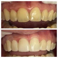 “La sonrisa también envejece: Cómo revertir el paso del tiempo por la Dra. Karina Pugliese de Araoz Dental”