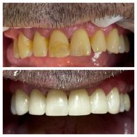 “La sonrisa también envejece: Cómo revertir el paso del tiempo por la Dra. Karina Pugliese de Araoz Dental”