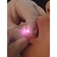 Odontología Avanzada: El Impacto del Láser en la Práctica Dental con el Dr. Gastón Pocai y la Dra. Vanesa García