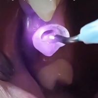 Odontología Avanzada: El Impacto del Láser en la Práctica Dental con el Dr. Gastón Pocai y la Dra. Vanesa García