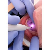 Odontología Avanzada: El Impacto del Láser en la Práctica Dental con el Dr. Gastón Pocai y la Dra. Vanesa García