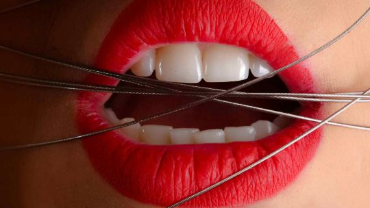 Los riesgos del labial dilatador para jóvenes que viralizó Kylie Jenner