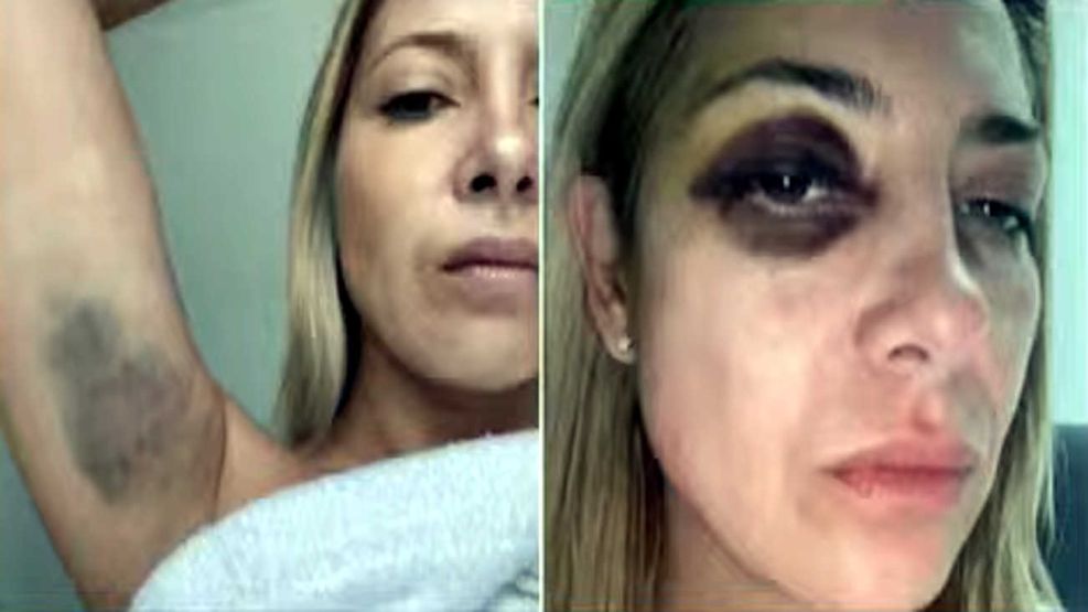 "Todo el tiempo me golpeas": impactantes chats y fotos de la denuncia de Fabiola Yañez contra Alberto Fernández