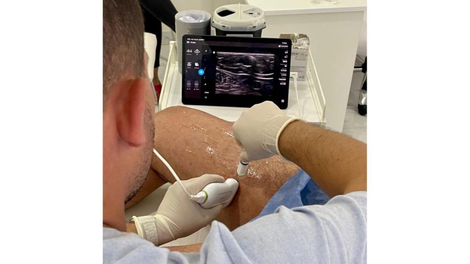 Cómo eliminar tus várices sin cirugía: Esclerosis guiada por ecografía en ROMA Medicina Estética