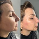 Dra. Gabriela Zoricich: Las claves en Armonización Orofacial para una Belleza Natural 