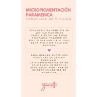 ¿Qué es el Vitiligo? Por Juliana Zanetti
