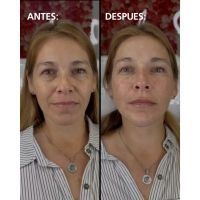 Dra. Cintia Burgos: Medicina estética para todos, Cambios sin cirugía en minutos y con cuidado profesional