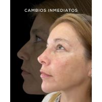 Dra. Cintia Burgos: Medicina estética para todos, Cambios sin cirugía en minutos y con cuidado profesional