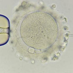 Fertilidad y Futuro: ¿Es posible prevenir la infertilidad? | Foto:CEDOC