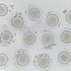 Fertilidad y Futuro: ¿Es posible prevenir la infertilidad? | Foto:CEDOC