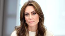 La operación desconocida de Kate Middleton que generó una cicatriz en su cabeza