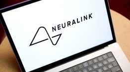 Musk Says First Neuralink Patient Received Implant In Brain 