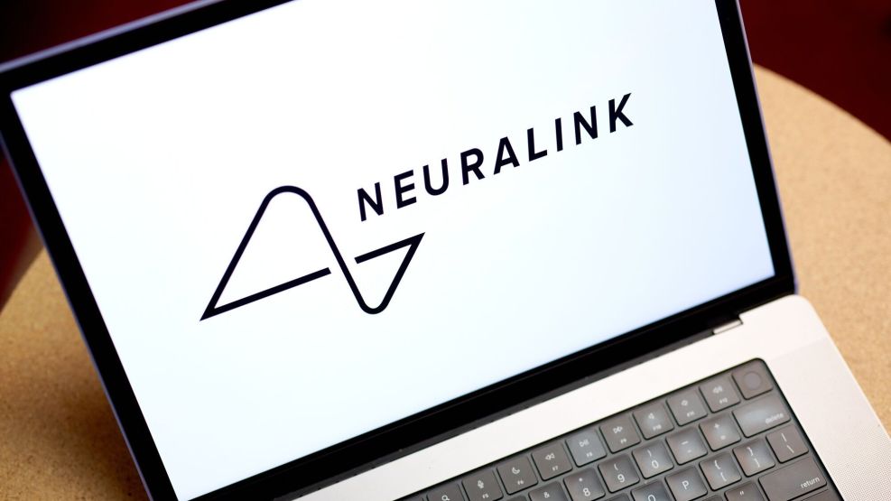 Musk Says First Neuralink Patient Received Implant In Brain 