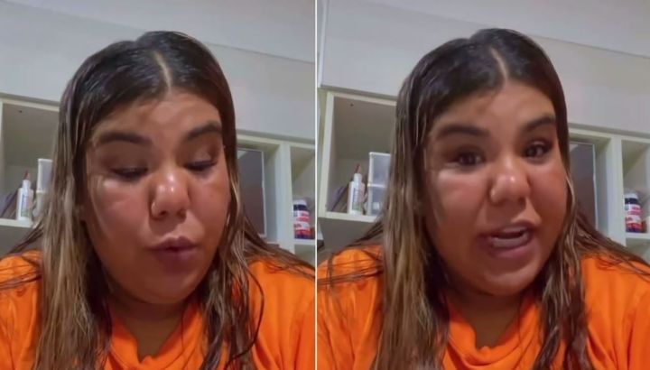 El pedido de ayuda de Camila "Camilota" Deniz tras ser diagnosticada con hipoacusia bilateral