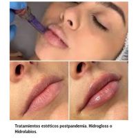 Tratamientos simples y rápidos para renovarnos en verano