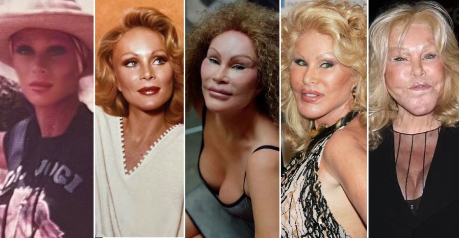 Murió Jocelyne Wildenstein, conocida como "Catwoman" por sus múltiples
