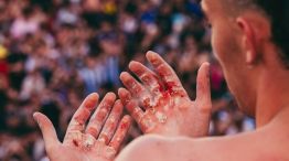 Las manos de Gero Arias tras batir el record de 366 dominadas en el Obelisco