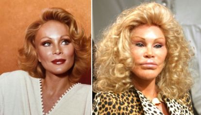 Jocelyne Wildenstein