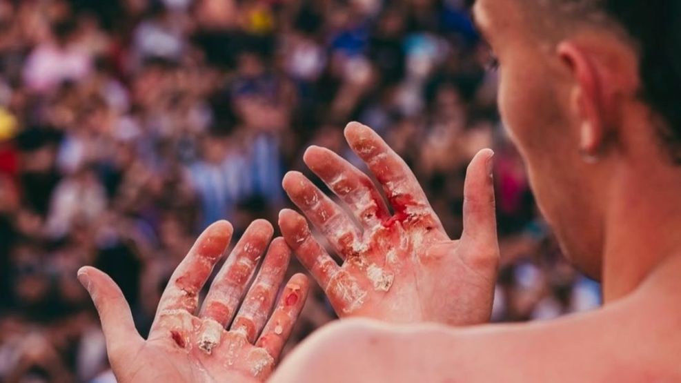 Las manos de Gero Arias tras batir el record de 366 dominadas en el Obelisco