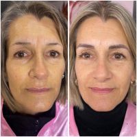 La Micropigmentación: Una Técnica Transformadora en el Mundo de la Belleza