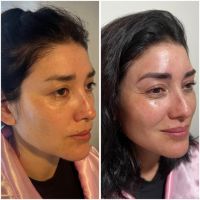 La Micropigmentación: Una Técnica Transformadora en el Mundo de la Belleza